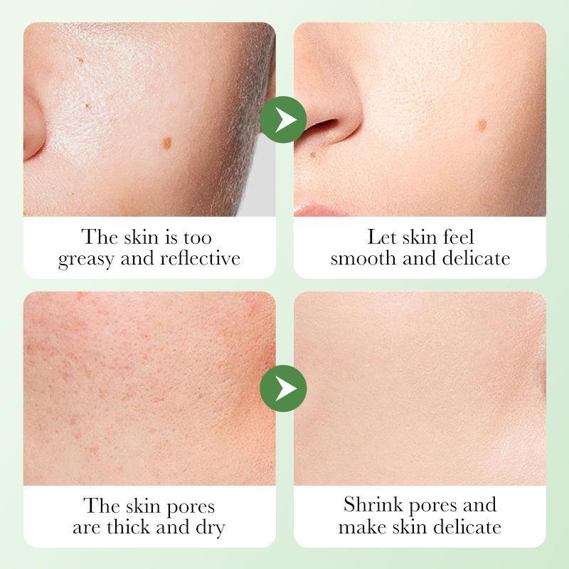 🌿 Complete Skin Care Set – Hydrating & Nourishing Facial Kit